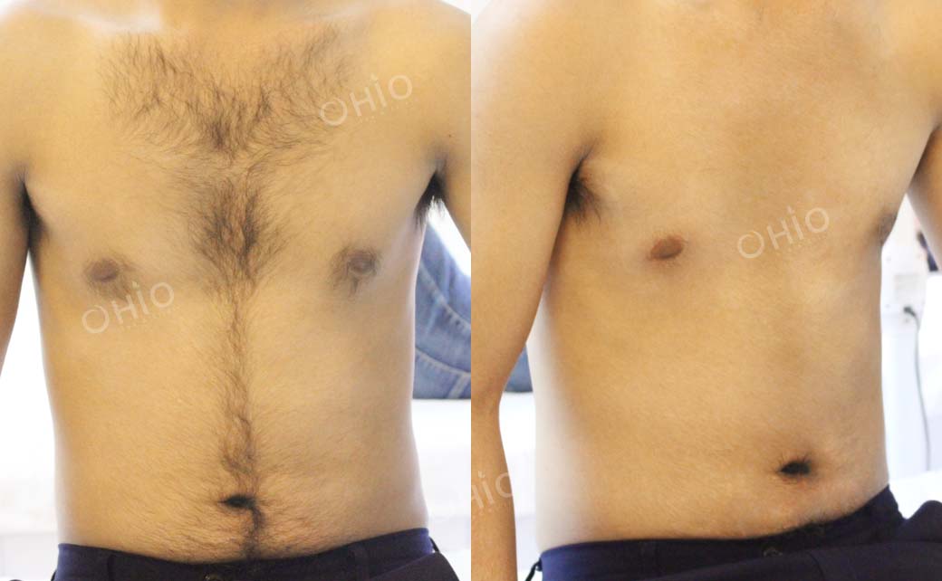 Kết quả sau dịch vụ 2