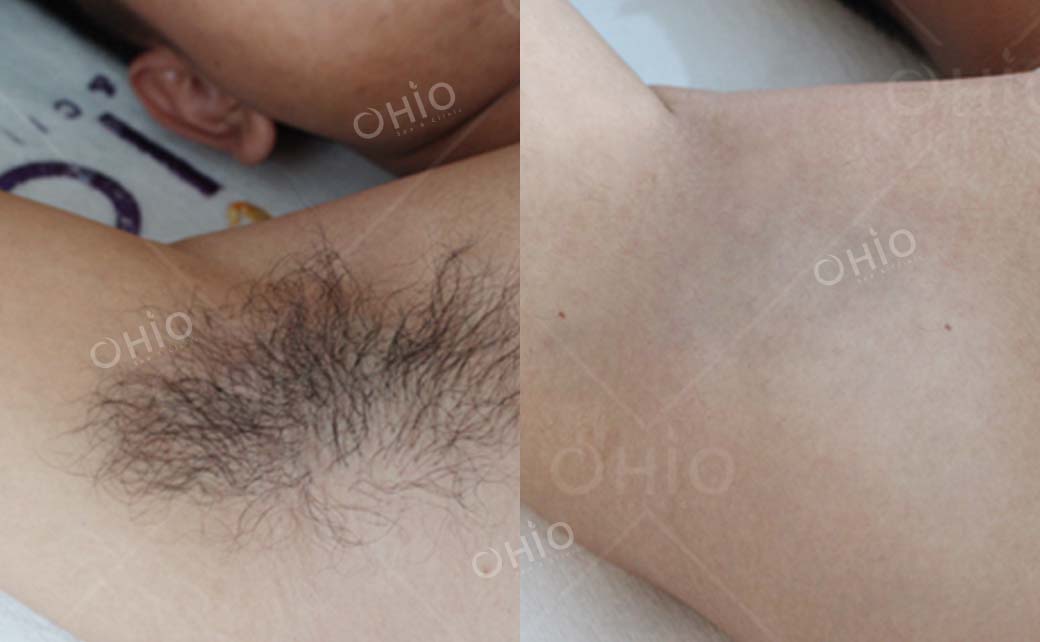 Kết quả sau dịch vụ 4
