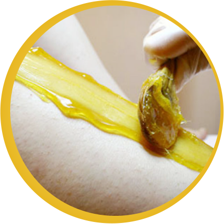 Phiền toái vì rậm lông 3