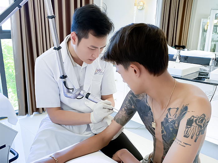 Xóa xăm Piconew 450 - Công nghệ xóa xăm tại phòng khám OHIO