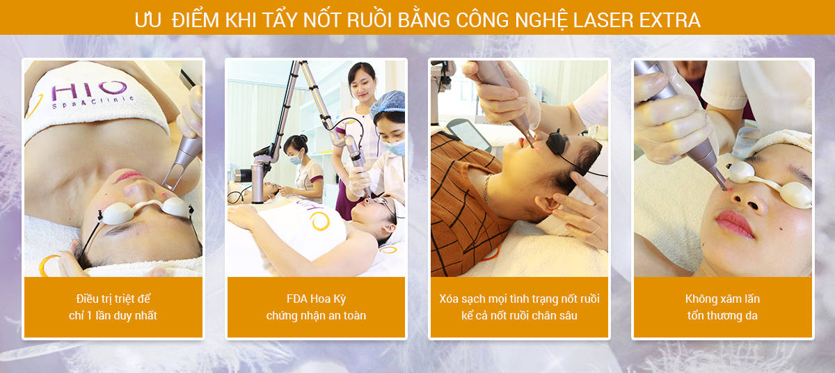 Cảnh Tỉnh cho những ai đang có ý định tự tẩy nốt ruồi tại nhà - Phòng khám da liễu OHIO Cảnh Tỉnh cho những ai đang có ý định tự tẩy nốt ruồi tại nhà