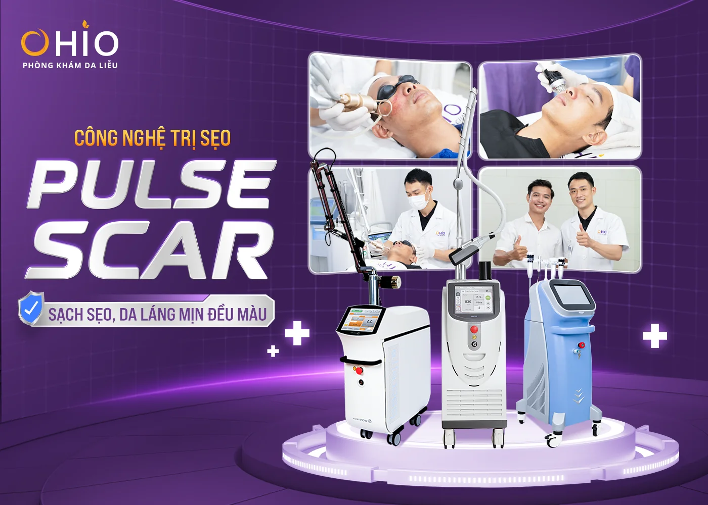 Điều trị sẹo thủy đậu hiệu quả cao - Phòng khám da liễu OHIO Tổ hợp đa công nghệ trị sẹo Pulse Scar
