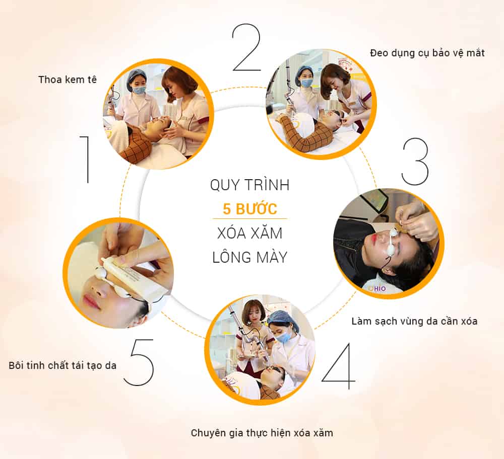 Xóa xăm lông mày 2
