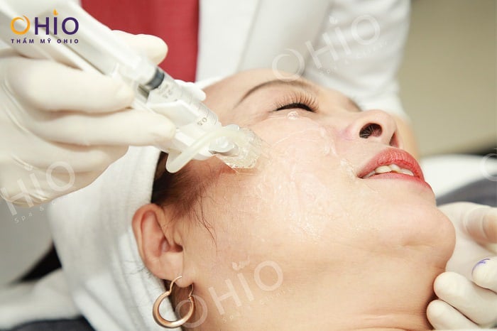 Cấy tinh chất Mulwang trẻ hóa da chuẩn Hàn - Phòng khám da liễu OHIO Cấy tinh chất Mulwang trẻ hóa da chuẩn Hàn