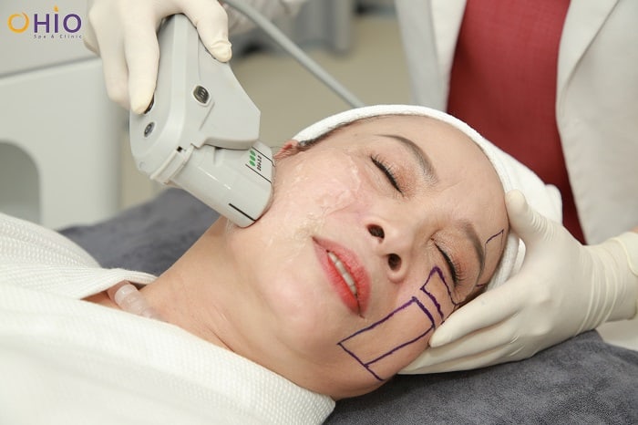 Tháng 7 rực rỡ - Sale lớn hết cỡ tại thẩm mỹ OHIO 116 Hoàng Ngân - Phòng khám da liễu OHIO Tháng 7 rực rỡ - Sale lớn hết cỡ tại thẩm mỹ OHIO 116 Hoàng Ngân