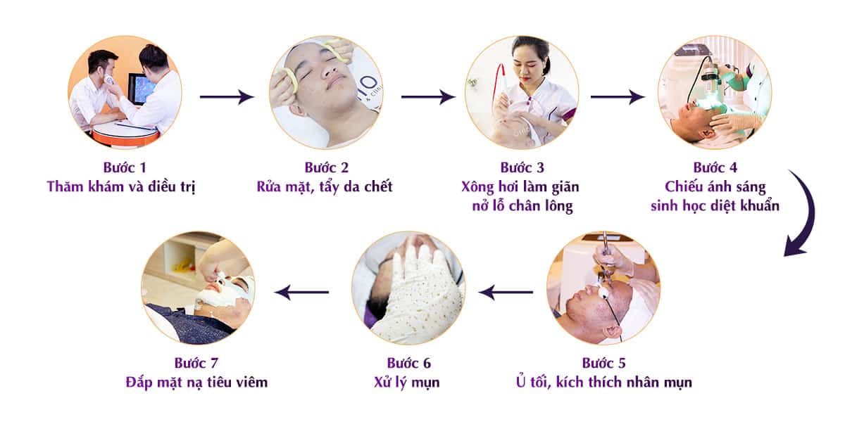 Trị mụn nam ở đâu thì tốt?