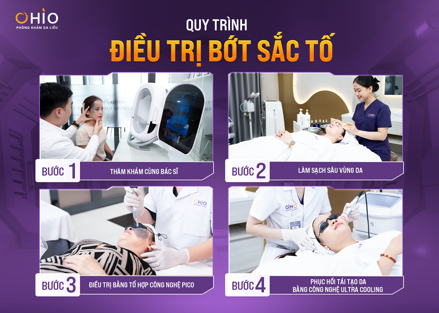 Tan nỗi âu lo chàm bớt với Tổ hợp công nghệ hiện đại tại Phòng khám OHIO - Phòng khám da liễu OHIO Tan nỗi âu lo chàm bớt với Tổ hợp công nghệ hiện đại tại Phòng khám OHIO