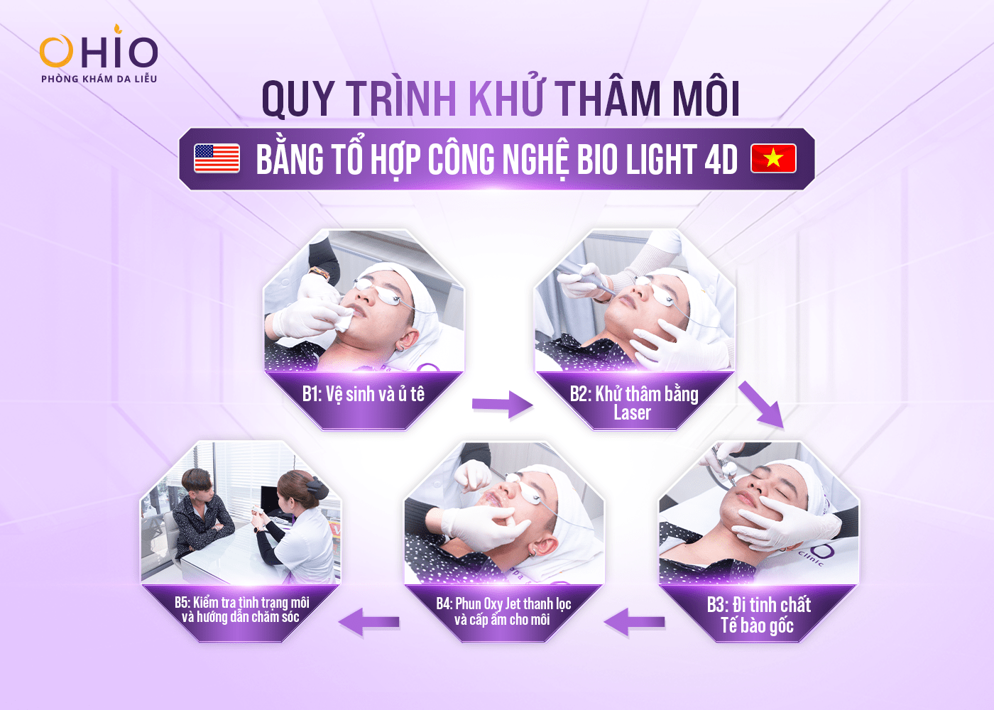 Tổ hợp công nghệ Bio Light 4D - Khử thâm Môi đẹp toàn diện, tự nhiên - Phòng khám da liễu OHIO Tổ hợp công nghệ Bio Light 4D - Khử thâm Môi đẹp toàn diện, tự nhiên