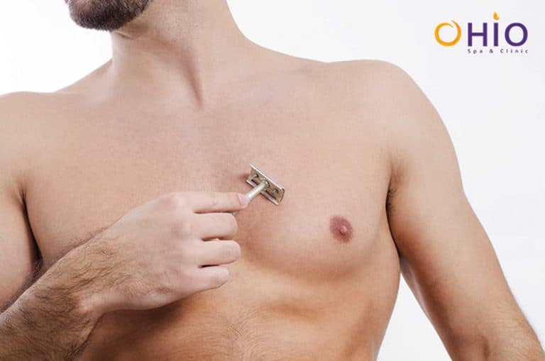 Triệt lông nam tại nhà không an toàn