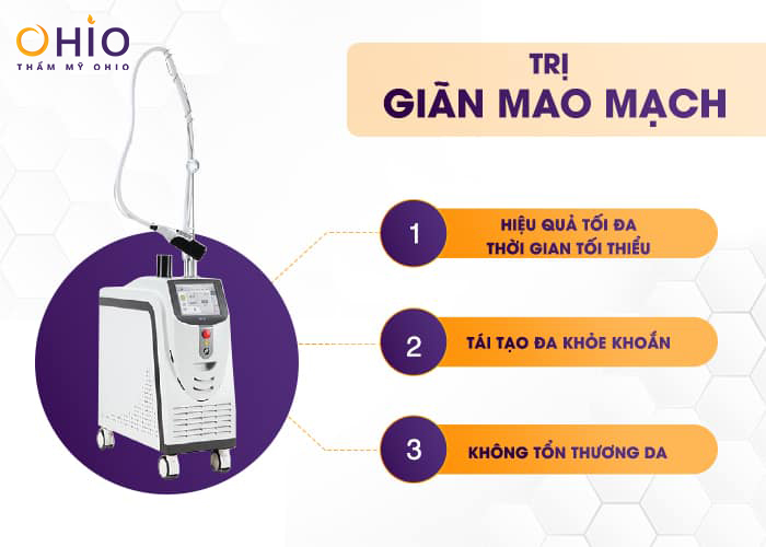 Trị giãn mao mạch Mercury LX - Vị trí nào cũng sạch - Phòng khám da liễu OHIO Trị giãn mao mạch ở đâu hiệu quả