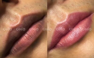 Khử thâm môi nam ở đâu tốt, màu tự nhiên và đẹp chuẩn men? - Phòng khám da liễu OHIO Khử thâm môi nam ở đâu tốt, màu tự nhiên và đẹp chuẩn men?