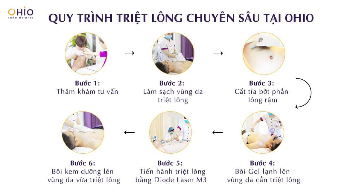 Diode Laser M3 - công nghệ triệt lông chuyên sâu đầu tiên dành cho nam giới! - Phòng khám da liễu OHIO Diode Laser M3 - công nghệ triệt lông chuyên sâu đầu tiên dành cho nam giới!