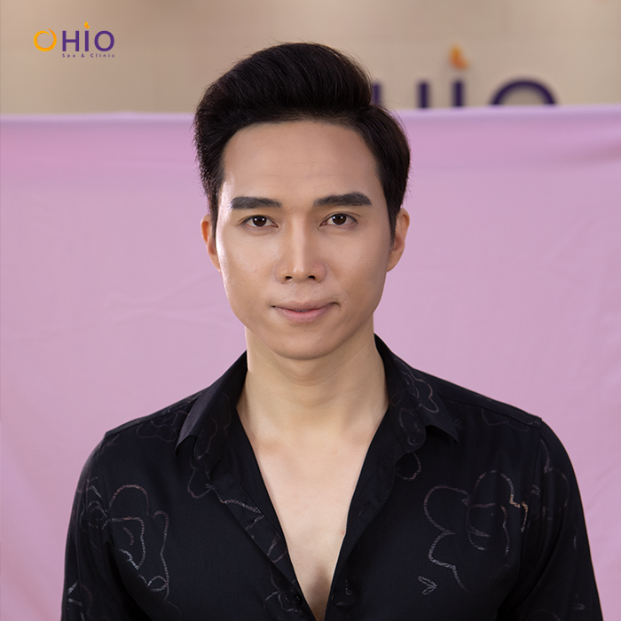 Tạo trán cao không cần cạo nhổ bằng cách nào? - Phòng khám da liễu OHIO Người trán cao là những người có vầng trán có khoảng cách từ mép tóc tới lông mày rộng