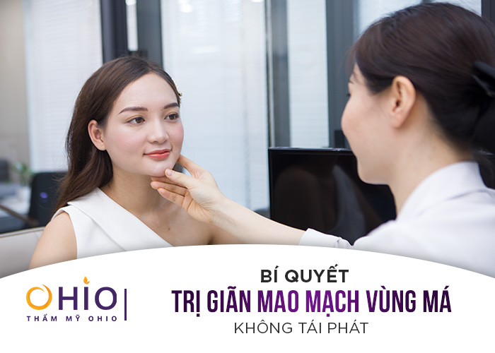 Bí quyết trị giãn mao mạch vùng má không tái phát