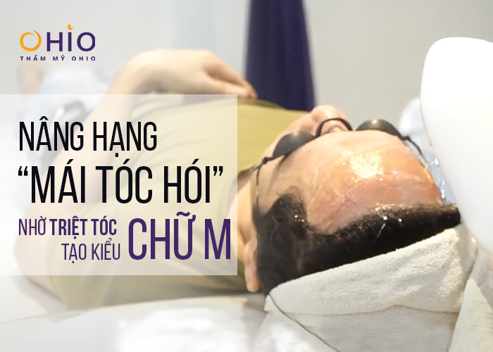 Nâng hạng “mái tóc hói” nhờ triệt tóc tạo kiểu chữ M