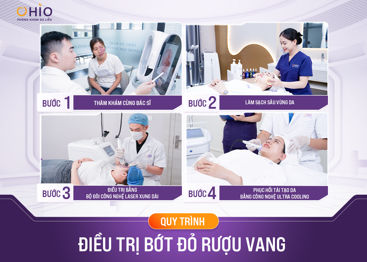 Phương pháp xóa chàm bớt đỏ, u máu hiệu quả và an toàn - Phòng khám da liễu OHIO Phương pháp xóa chàm bớt đỏ, u máu hiệu quả và an toàn