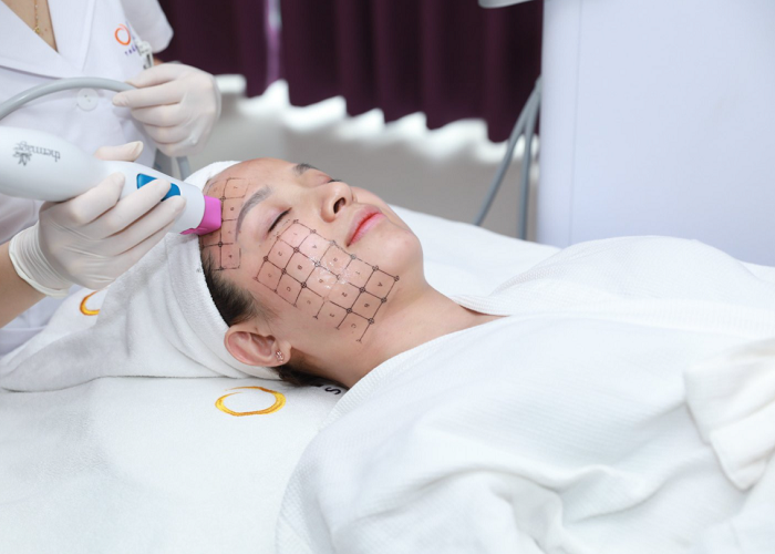 Top 5 ca trẻ hóa thay đổi ngoạn mục dưới bàn tay tài hoa bác sĩ Trịnh Trung Thực - Phòng khám da liễu OHIO trẻ hóa làn da 1