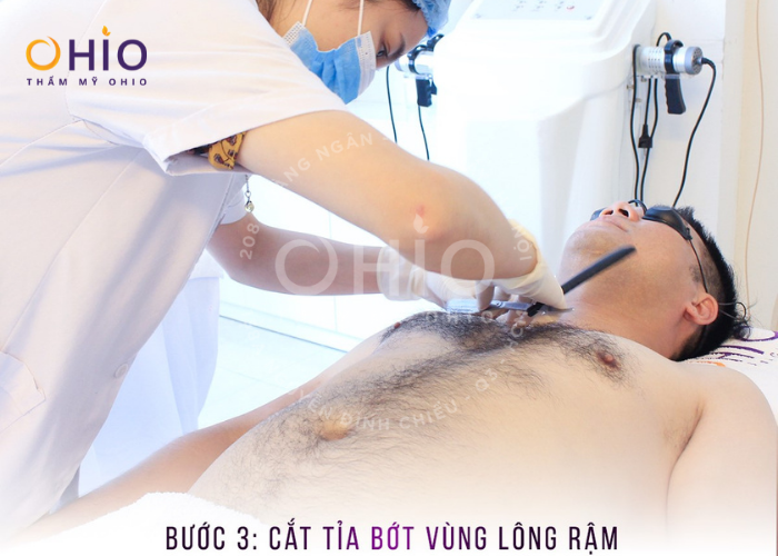 Rắc rối mùi dưới cánh tay - Xua ngay với triệt lông Aqua Max - Phòng khám da liễu OHIO Thực hiện loại bỏ vùng lông rậm rạp.