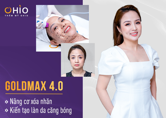 Chuyên gia nói gì về xu hướng làm đẹp mới GOLDMAX 2022 - Phòng khám da liễu OHIO cang-da-khong-phau-thuat