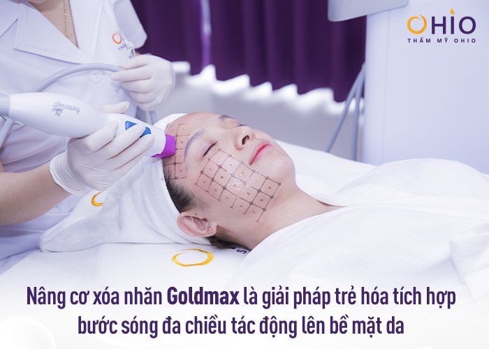 GOLDMAX - Công nghệ nâng cơ xóa nhăn dẫn đầu thị trường 2022 - Phòng khám da liễu OHIO Ưu điểm của công nghệ nâng cơ xóa nhăn goldmax