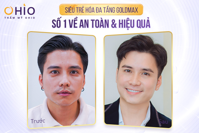 NSND Thanh Thủy, diễn viên Mạnh Quân, Hoàng Yến, Hari Oanh,...Bật mí về làn da trẻ đẹp của mình nhờ công nghệ Goldmax - Phòng khám da liễu OHIO Trẻ hóa làn da chỉ sau một lần trải nghiệm công nghệ Goldmax 4.0