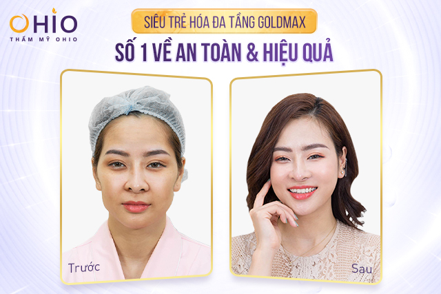 NSND Thanh Thủy, diễn viên Mạnh Quân, Hoàng Yến, Hari Oanh,...Bật mí về làn da trẻ đẹp của mình nhờ công nghệ Goldmax - Phòng khám da liễu OHIO Siêu trẻ hóa nâng cơ xóa nhăn goldmax