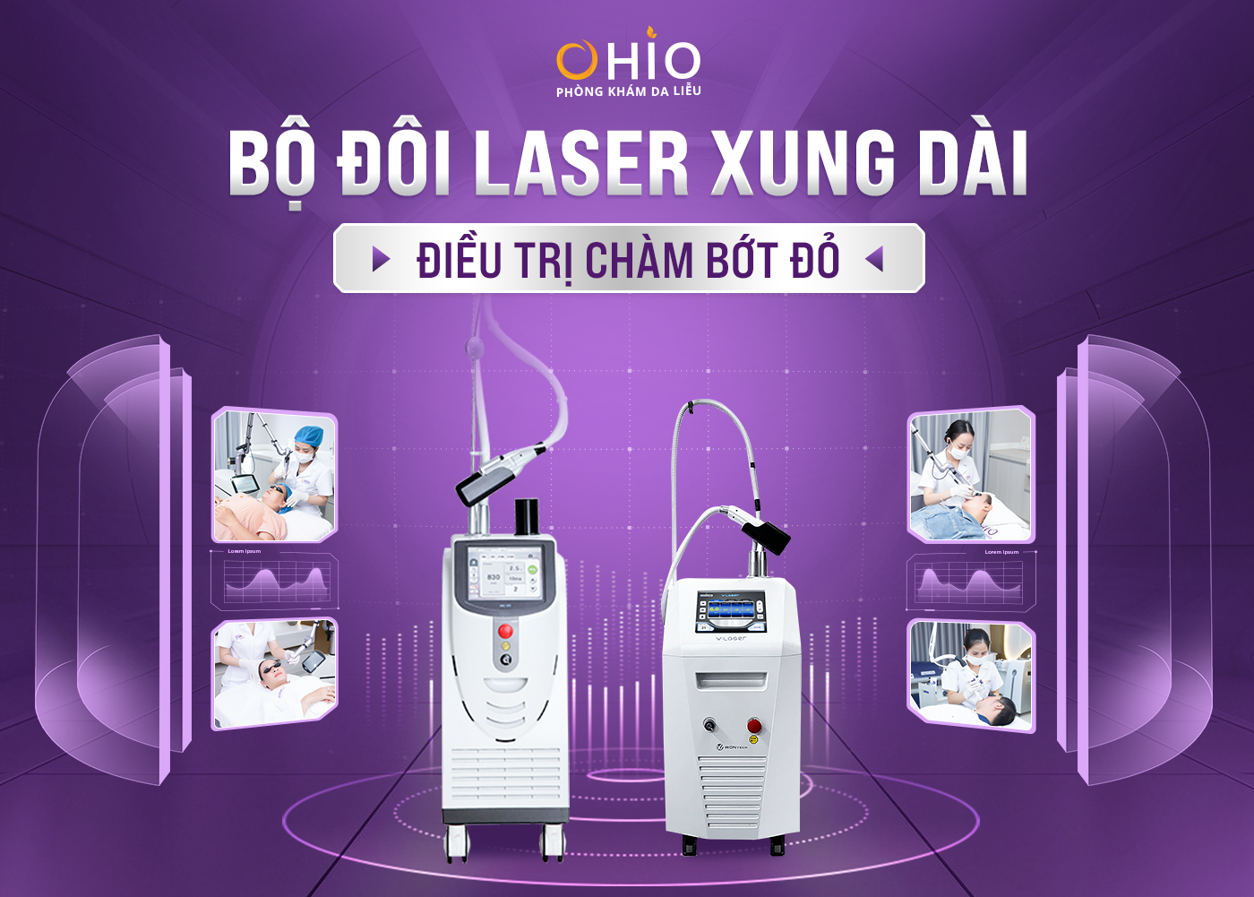 Phương pháp xóa chàm bớt đỏ, u máu hiệu quả và an toàn - Phòng khám da liễu OHIO Phương pháp xóa chàm bớt đỏ, u máu hiệu quả và an toàn