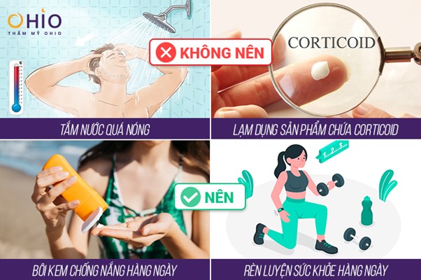 Giãn mao mạch là gì? Nguyên nhân và phương pháp điều trị hiệu quả