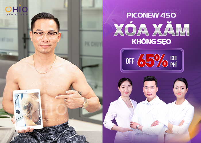 Hè sang ngập tràn quà tặng - Giảm 65% dịch vụ HOT - 500 voucher làm đẹp - Phòng khám da liễu OHIO Hè sang ngập tràn quà tặng - Giảm 65% dịch vụ HOT - 500 voucher làm đẹp