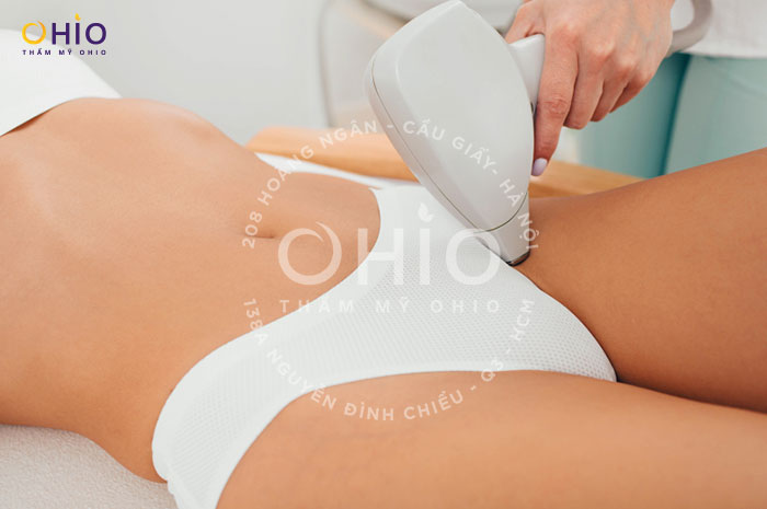 Bật mí phương pháp triệt lông cho nữ an toàn và hiệu quả - Phòng khám da liễu OHIO Bật mí phương pháp triệt lông cho nữ an toàn và hiệu quả