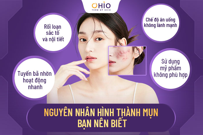 “Bật mí” phương pháp trị mụn chuẩn Nhật - Da căng bóng đẹp tức thì