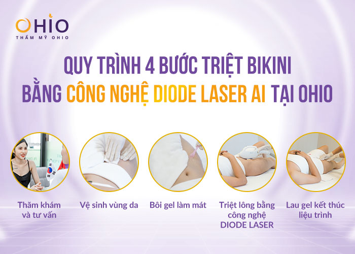 Diode Laser AI - Công nghệ triệt bikini nữ lên ngôi dịp hè 2023 - Phòng khám da liễu OHIO Diode Laser AI - Công nghệ triệt bikini nữ lên ngôi dịp hè 2023