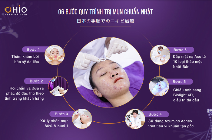 “Bật mí” phương pháp trị mụn chuẩn Nhật - Da căng bóng đẹp tức thì