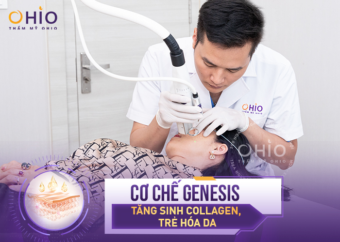 Trị giãn mao mạch Mercury LX: Liệu trình ngắn, hiệu quả nhanh chóng - Phòng khám da liễu OHIO Trị giãn mao mạch Mercury LX: Liệu trình ngắn, hiệu quả nhanh chóng