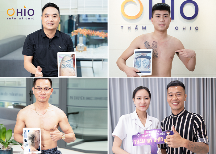 Chiến dịch Xoá hình xăm không sẹo