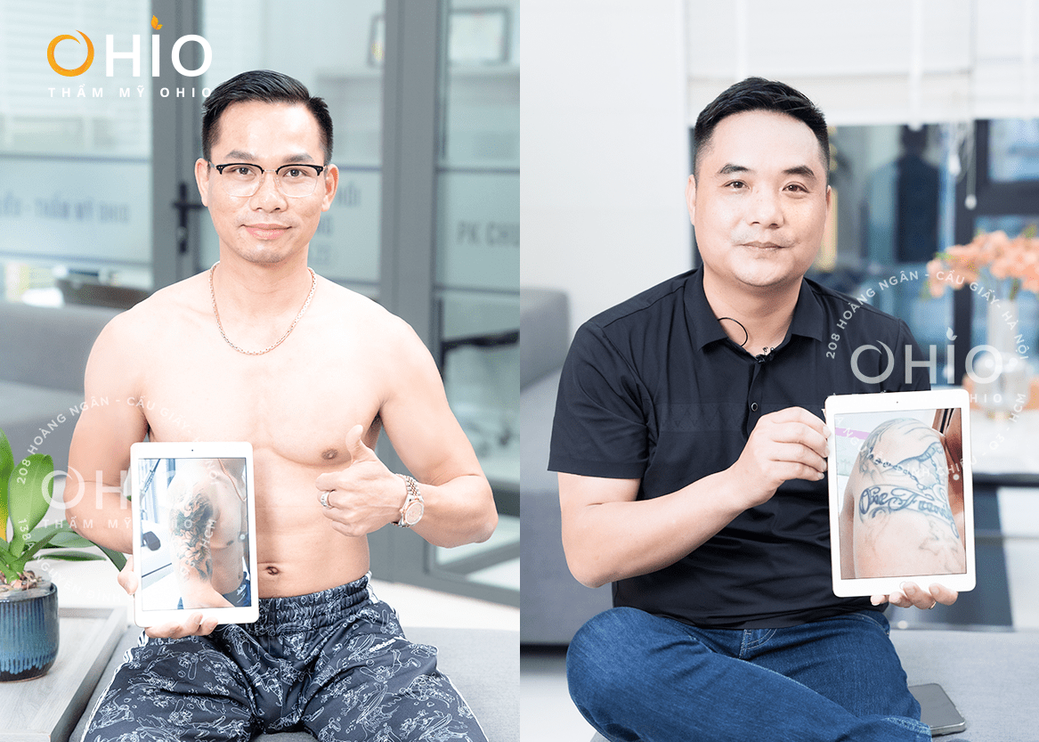 Cơ sở xóa xăm an toàn và uy tín tại Hà Nội: Những điều cần biết trước khi đưa ra quyết định - Phòng khám da liễu OHIO Cơ sở xóa xăm an toàn và uy tín tại Hà Nội: Những điều cần biết trước khi đưa ra quyết định