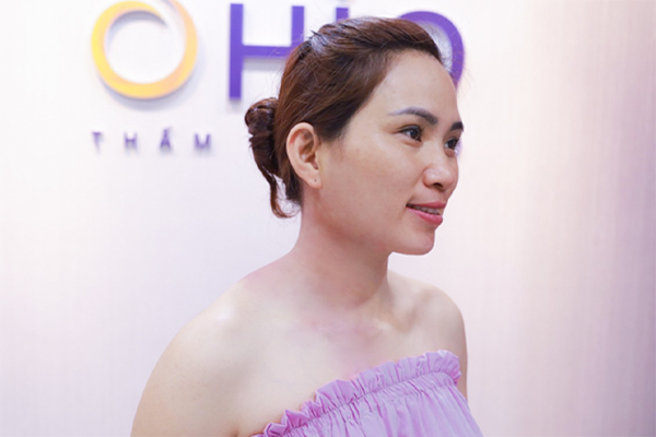 Chàm bớt có nguy hiểm không, điều trị thế nào?