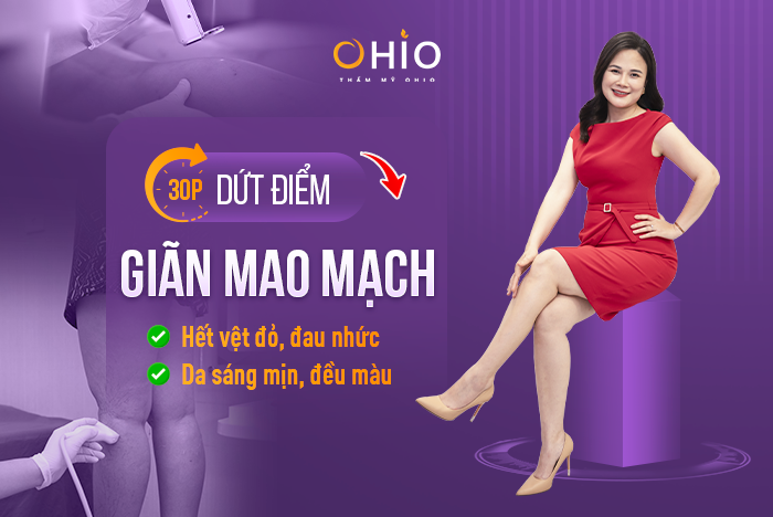 Review trị giãn mao mạch thực tế tại Thẩm mỹ OHIO - Phòng khám da liễu OHIO Review trị giãn mao mạch thực tế tại Thẩm mỹ OHIO