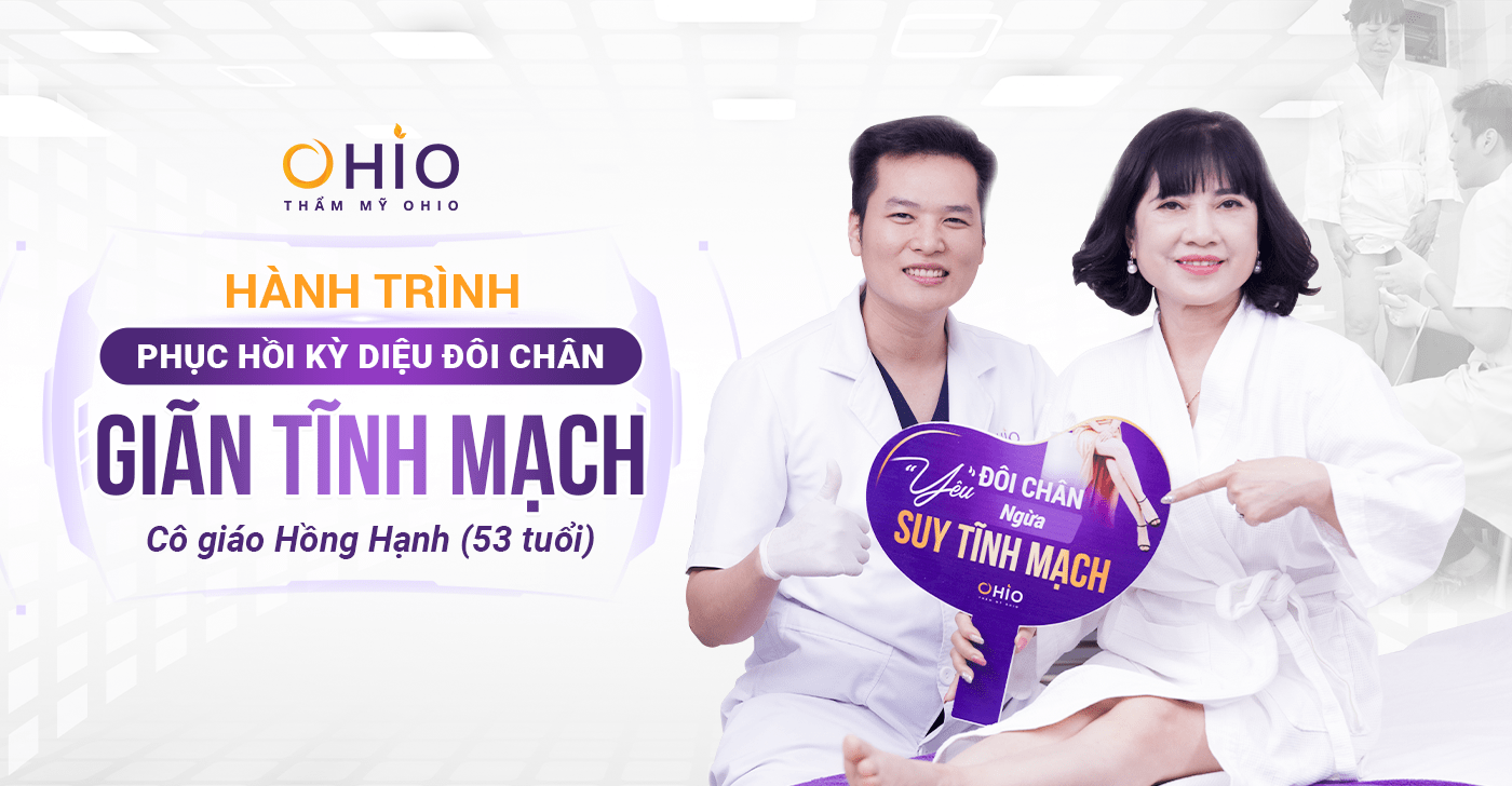 giãn tĩnh mạch