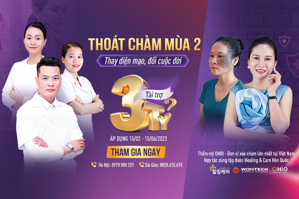 Chiến dịch Thoát Chàm 2023 thay diện mạo - đổi cuộc đời cho hàng ngàn khách hàng - Phòng khám da liễu OHIO Chiến dịch Thoát Chàm 2023 thay diện mạo - đổi cuộc đời cho hàng ngàn khách hàng