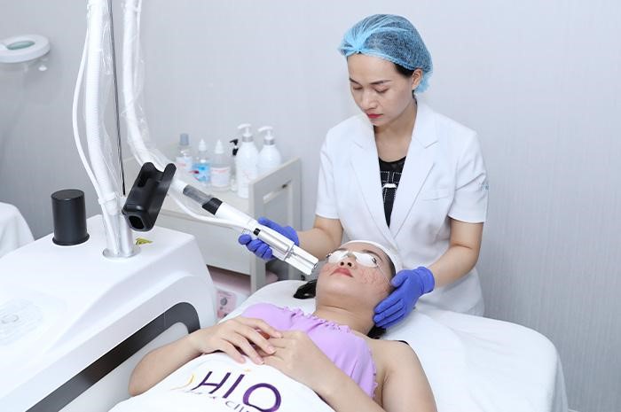 Trị giãn mao mạch có chấm dứt không? - Phòng khám da liễu OHIO trị giãn mao mạch kết thúc 2