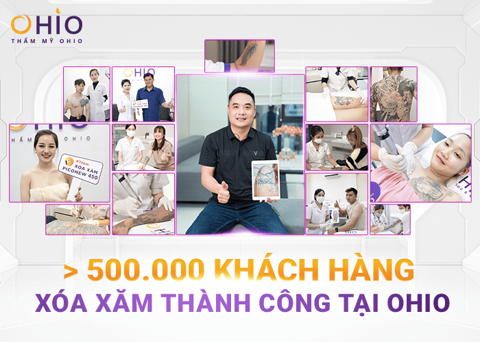 Anh Trung Kiên: Tôi đã xóa sạch hình xăm lâu năm tại OHIO! - Phòng khám da liễu OHIO Anh Trung Kiên: Tôi đã xóa sạch hình xăm lâu năm tại OHIO!