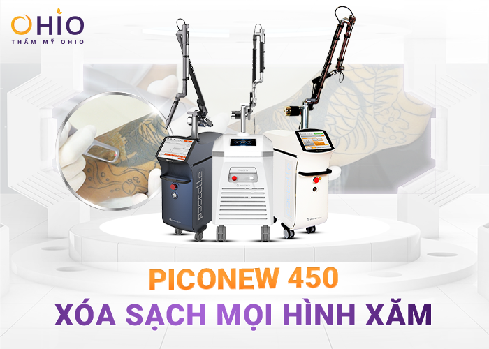 Anh Hưng (Hưng Yên): Xóa hình xăm, công việc của tôi thuận lợi hơn! - Phòng khám da liễu OHIO Anh Hưng (Hưng Yên): Xóa hình xăm, công việc của tôi thuận lợi hơn!