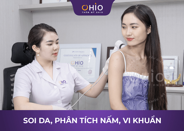 Chị Ngọc Lan: Dứt điểm bệnh viêm nang lông nhờ Matrixlight - Phòng khám da liễu OHIO Chị Ngọc Lan: Dứt điểm bệnh viêm nang lông nhờ Matrixlight