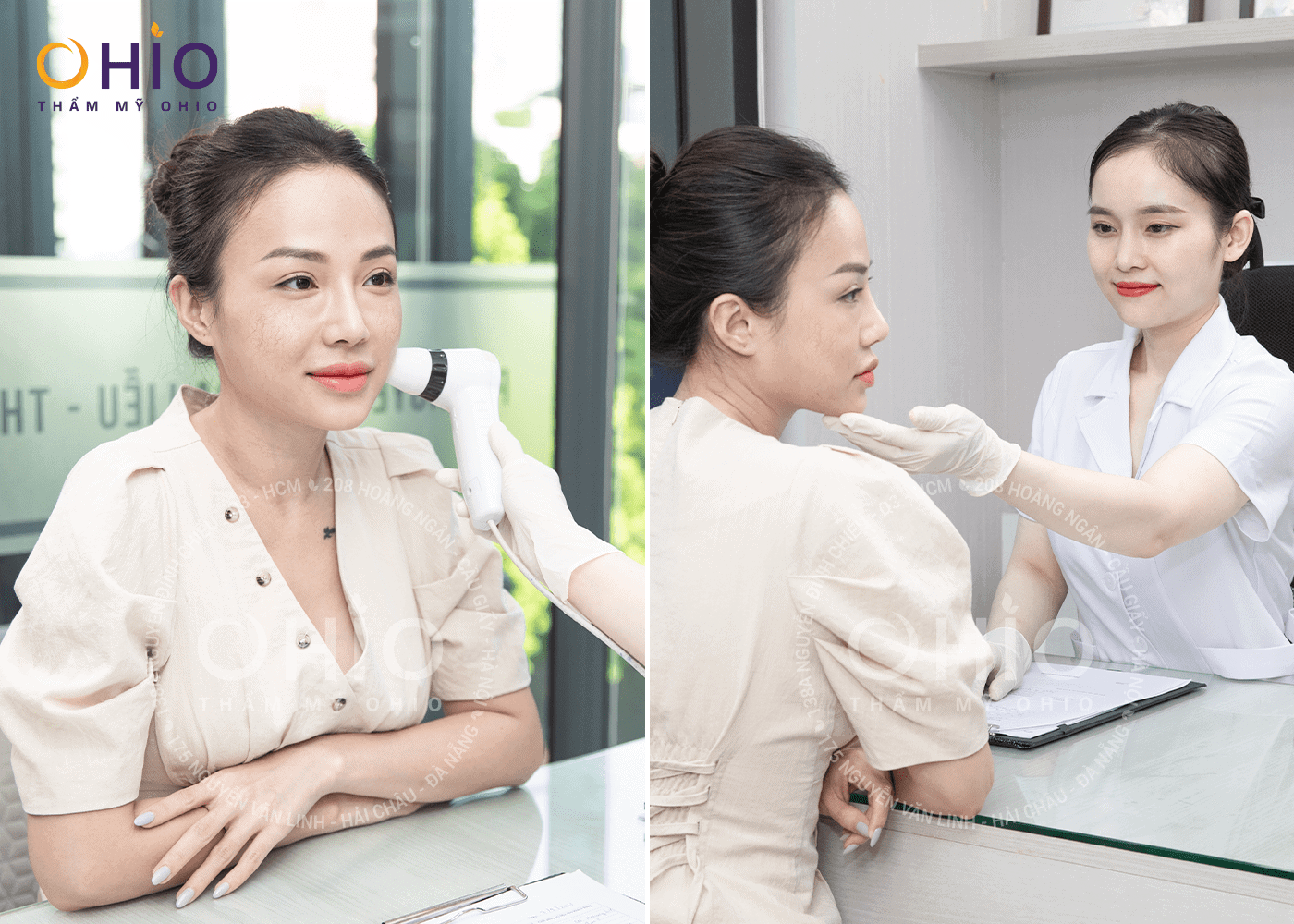 Hot Mom Huyền Trang: Tự tin làm mẫu ảnh khi hết giãn mao mạch - Phòng khám da liễu OHIO Hot Mom Huyền Trang: Tự tin làm mẫu ảnh khi hết giãn mao mạch