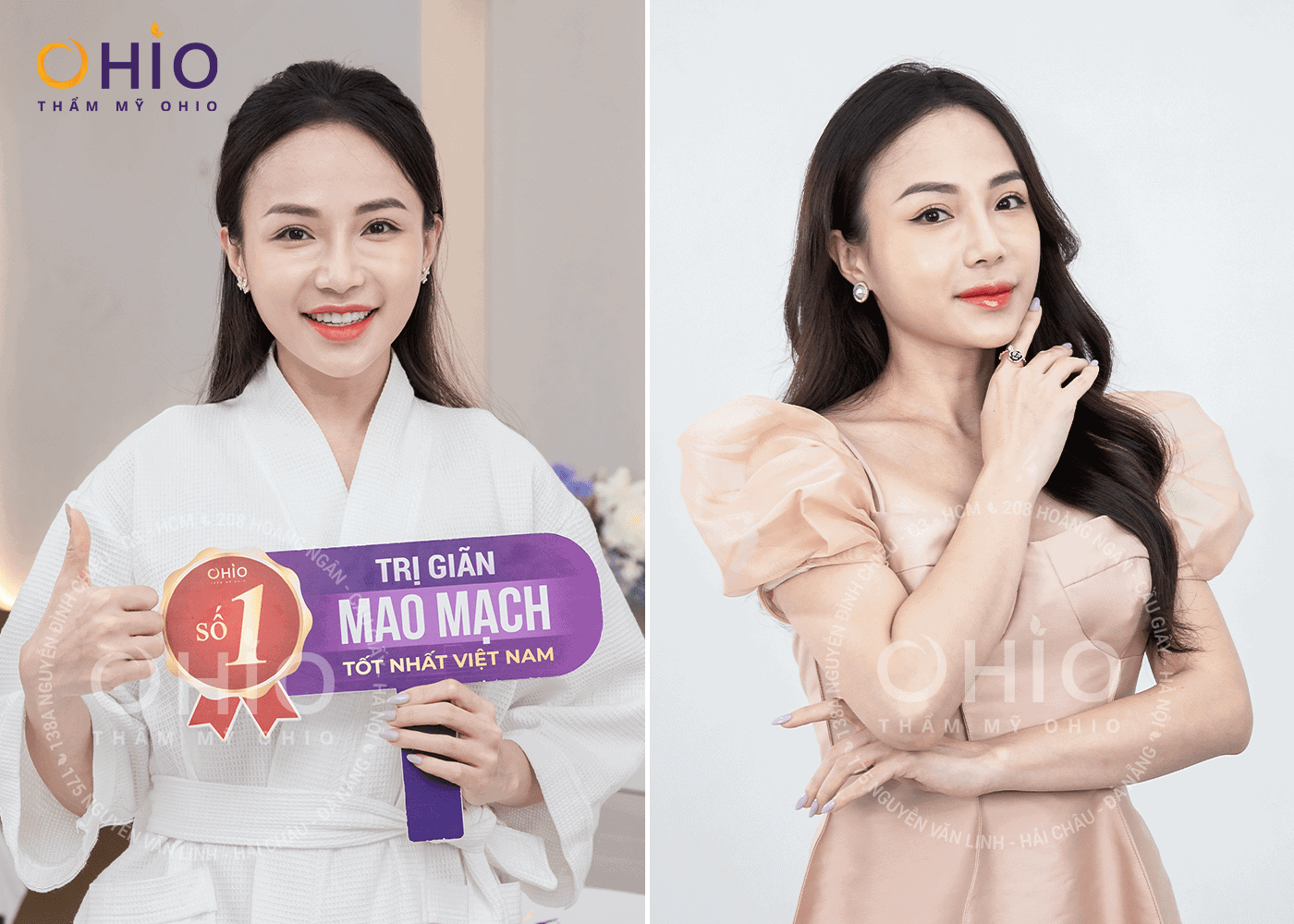 Hot Mom Huyền Trang: Tự tin làm mẫu ảnh khi hết giãn mao mạch - Phòng khám da liễu OHIO Hot Mom Huyền Trang: Tự tin làm mẫu ảnh khi hết giãn mao mạch