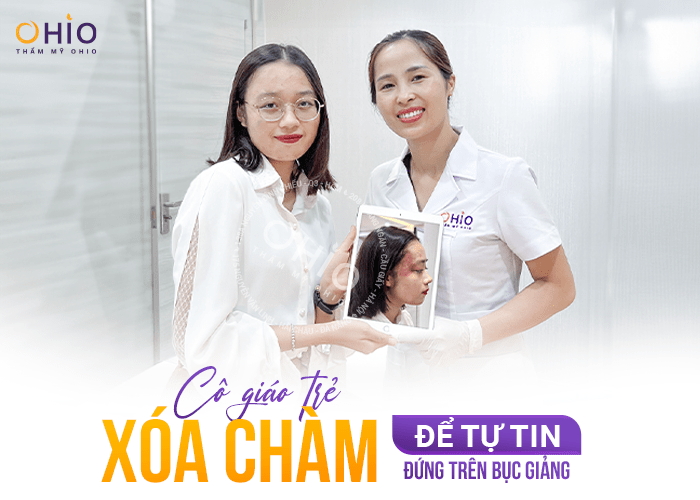 Bùi Trang: Tôi tự tin đứng trên bục giảng nhờ xóa bớt rượu vang tại OHIO - Phòng khám da liễu OHIO Bùi Trang: Tôi tự tin đứng trên bục giảng nhờ xóa bớt rượu vang tại OHIO
