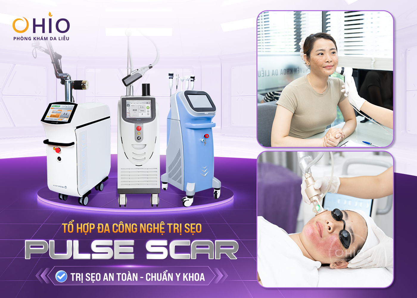 Tổ hợp đa công nghệ trị sẹo Pulse Scar