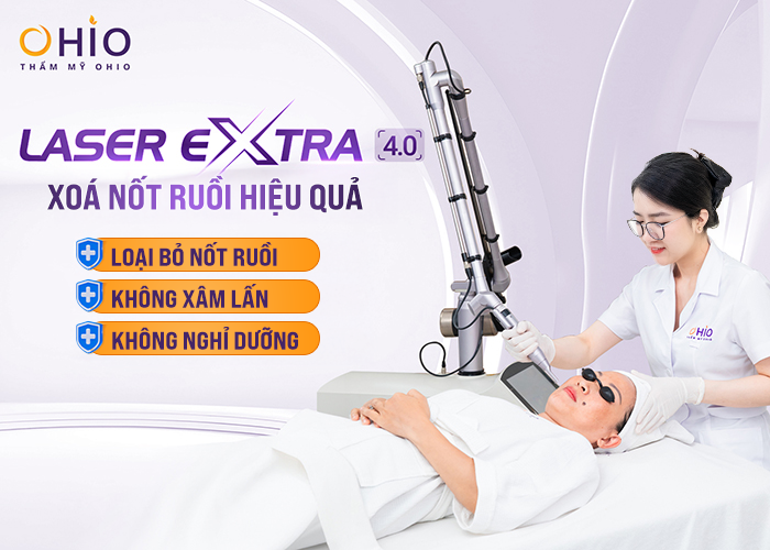 Laser Extra - Xóa sạch nốt ruồi - Phòng khám da liễu OHIO Laser Extra - Xóa sạch nốt ruồi