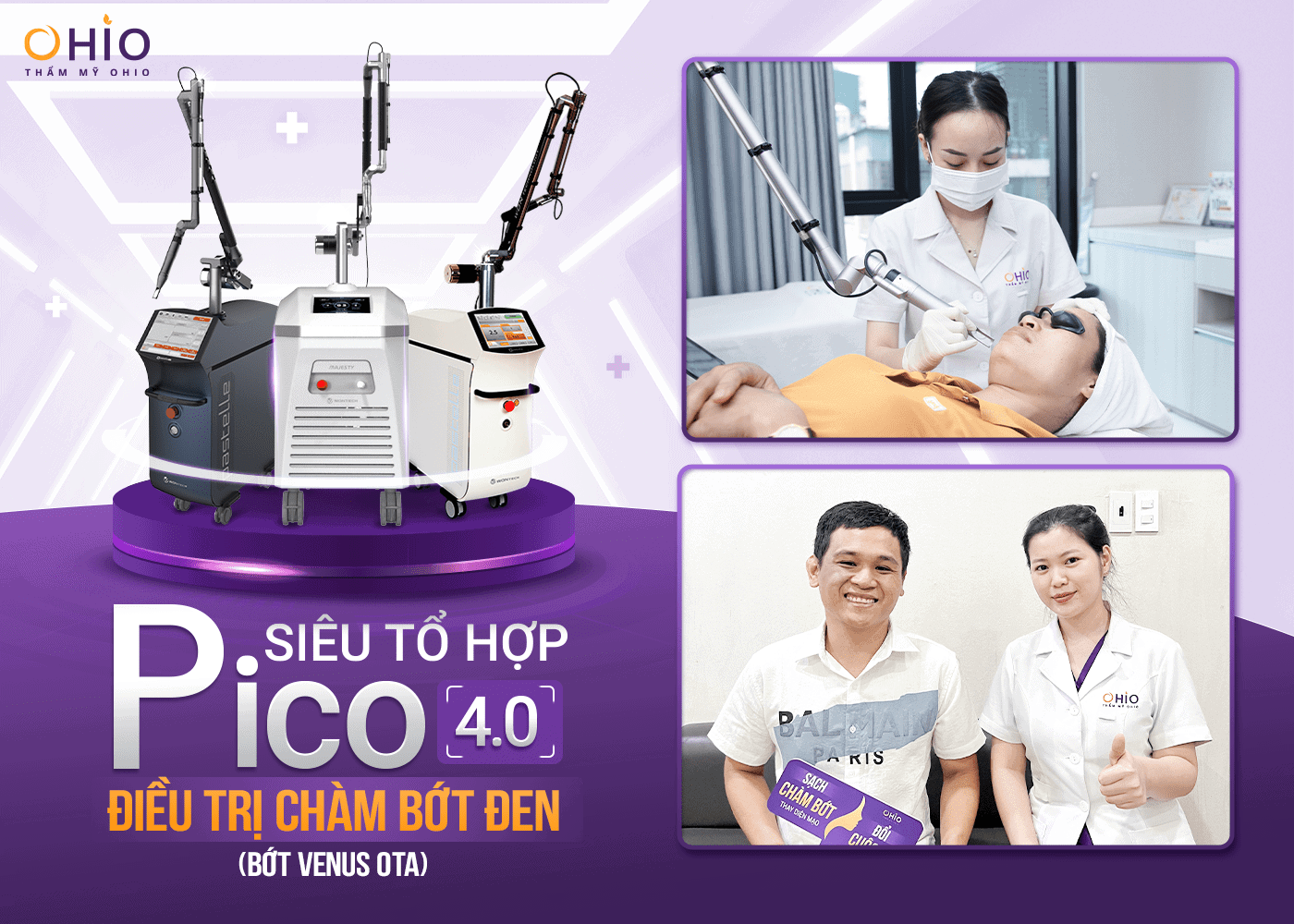 Chàm bớt OTA và 4 điều bạn cần biết ! - Phòng khám da liễu OHIO Chàm bớt OTA và 4 điều bạn cần biết !